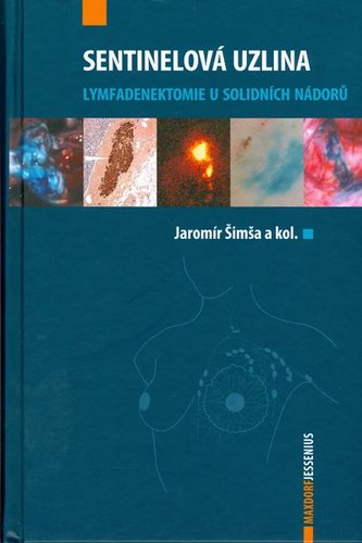Obrázok Sentinelová uzlina