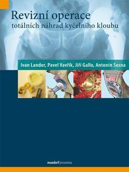 Obrázok Revizní operace totálních náhrad kyčelního kloubu