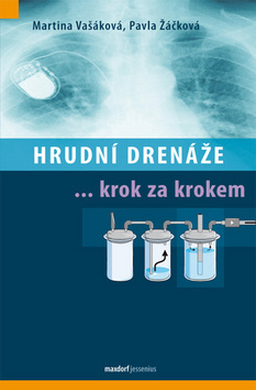 Obrázok Hrudní drenáže krok za krokem