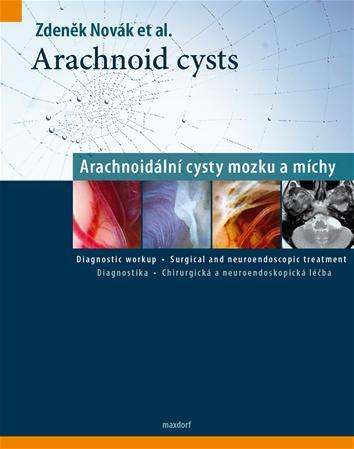 Obrázok Arachnoid cysts - Arachnoidální cysty mozku a míchy