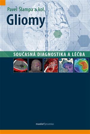 Obrázok Gliomy - Současná diagnostika a léčba