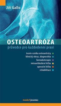 Obrázok Osteoartróza
