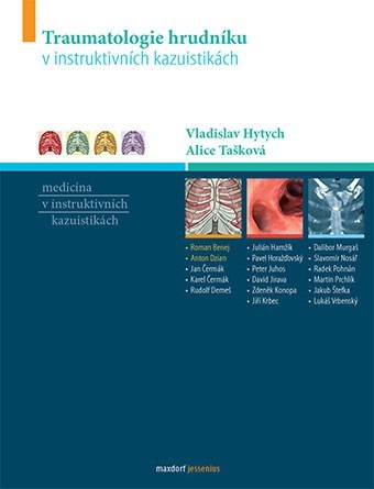 Obrázok Traumatologie hrudníku v instruktivních kazuistikách