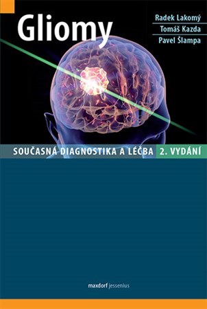 Obrázok Gliomy - Současná diagnostika a léčba