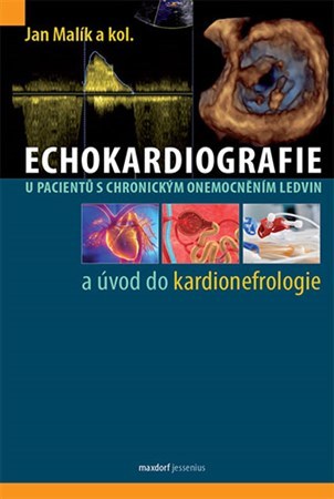 Obrázok Echokardiografie u pacientů s chronickým onemocněním ledvin a úvod do kardionefrologie