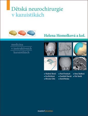 Obrázok Dětská neurochirurgie v kazuistikách