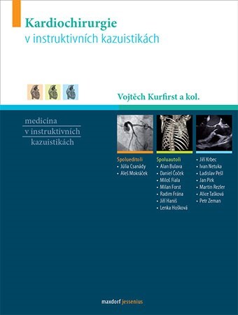 Obrázok Kardiochirurgie v instruktivních kazuist