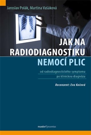 Obrázok Jak na radiodiagnostiku nemocí plic