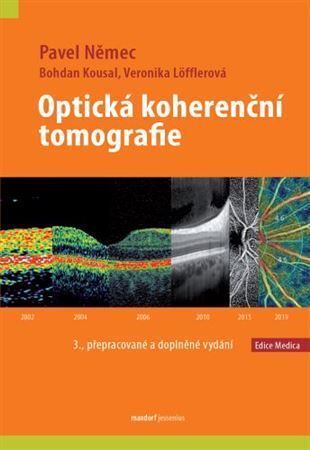 Obrázok Optická koherenční tomografie
