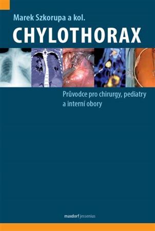 Obrázok Chylothorax - Průvodce pro chirurgy, pediatry a interní obory