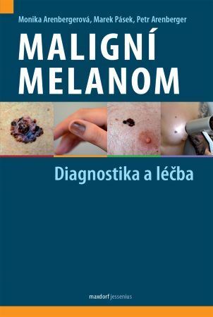 Obrázok Maligní melanom - Diagnostika a léčba