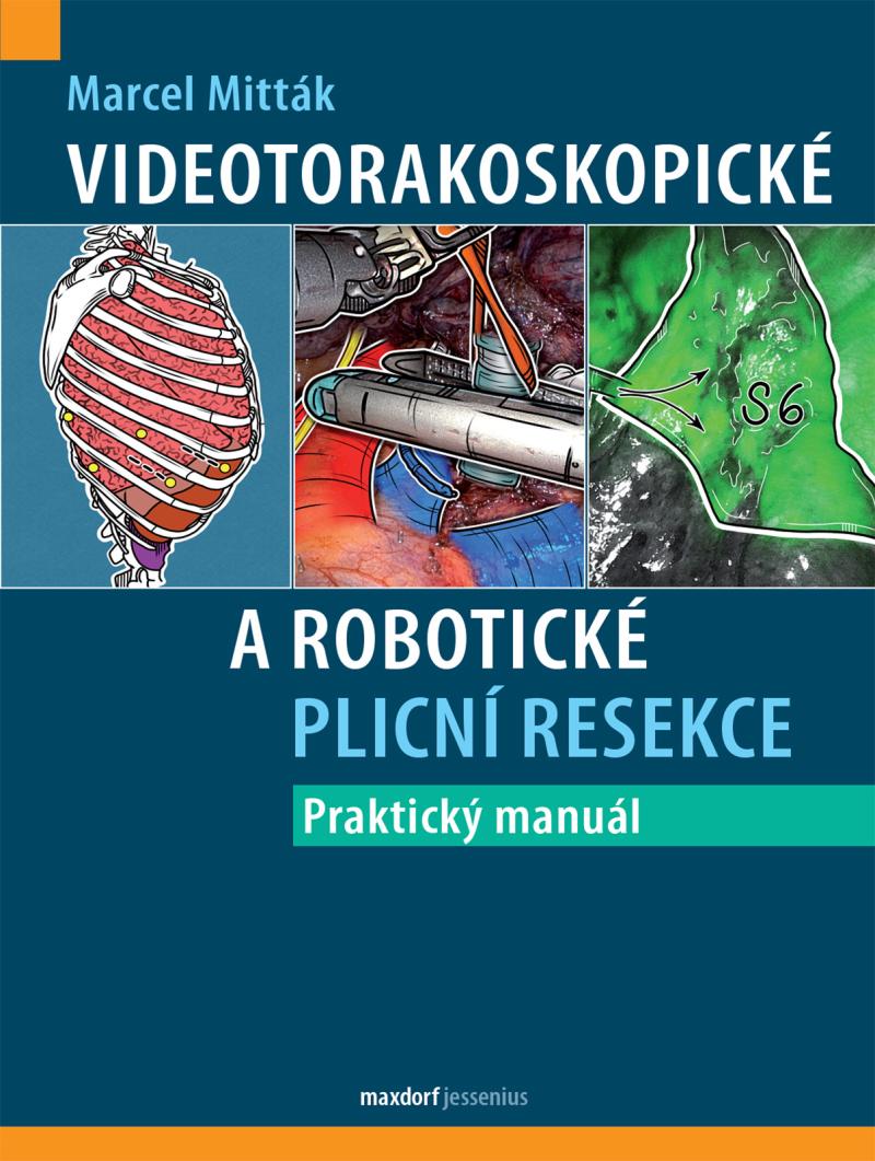 Obrázok Videotorakoskopické a robotické plicní resekce