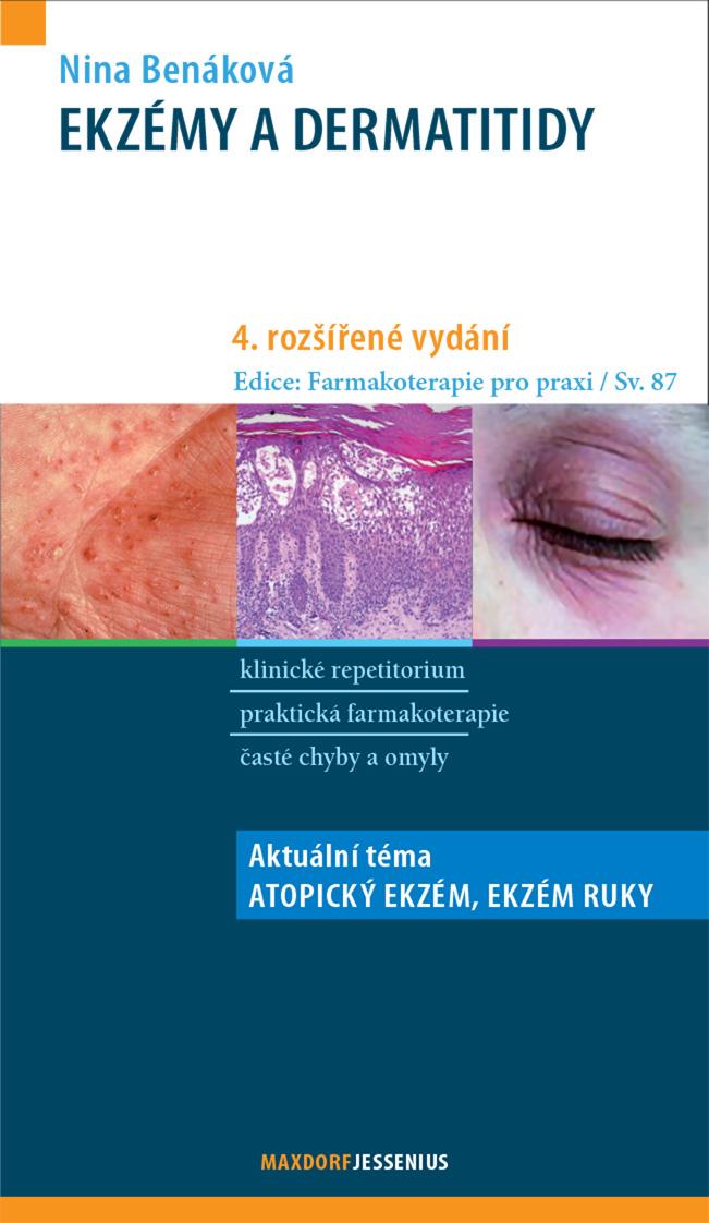 Obrázok Ekzémy a dermatitidy