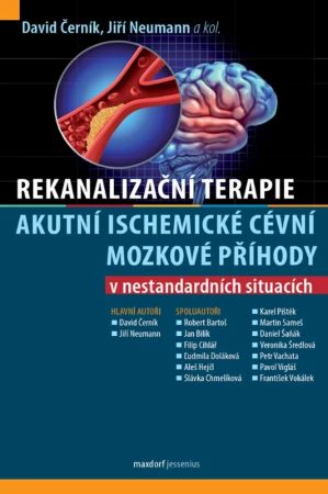 Obrazok Rekanalizační terapie akutní ischemické cévní mozkové příhody v nestandardních situacích