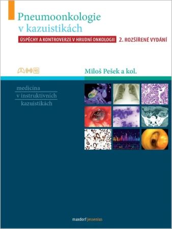 Obrazok Pneumoonkologie v kazuistikách (2.vyd.) - Úspěchy a kontroverze v hrudní onkologii