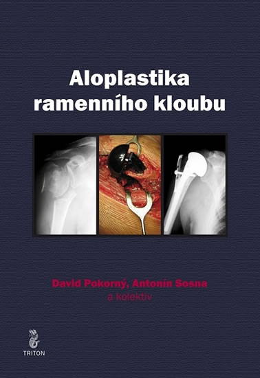Obrázok Aloplastika ramenního kloubu