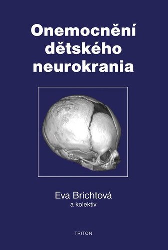 Obrázok Onemocnění dětského neurokrania