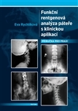 Obrázok Funkční rentgenová analýza páteře s klinickou aplikací