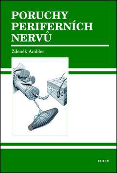 Obrázok Poruchy periferních nervů