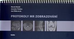 Obrázok Protokoly MR Zobrazování