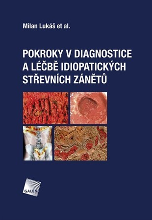 Obrázok Pokroky v diagnostice a léčbě idiopatick