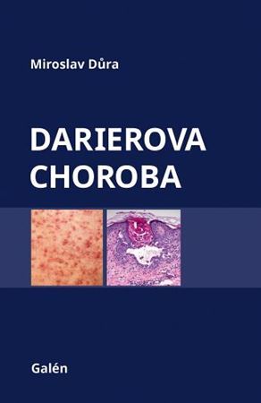 Obrázok Darierova choroba