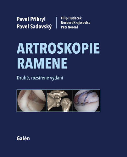 Obrázok Artroskopie ramene