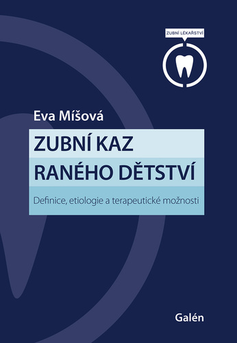 Obrázok Zubní kaz raného dětství - Definice, etiologie a terapeutické možnosti