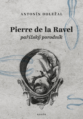 Obrázok Pierre de la Ravel, pařížský porodník