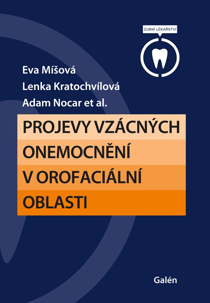 Obrázok Projevy vzácných onemocnění v orofaciální oblasti