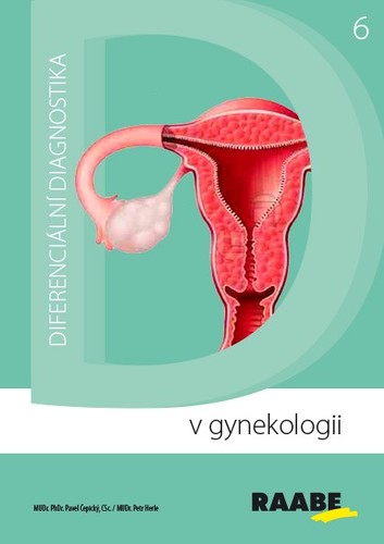 Obrázok Diferenciální diagnostika v gynekologii
