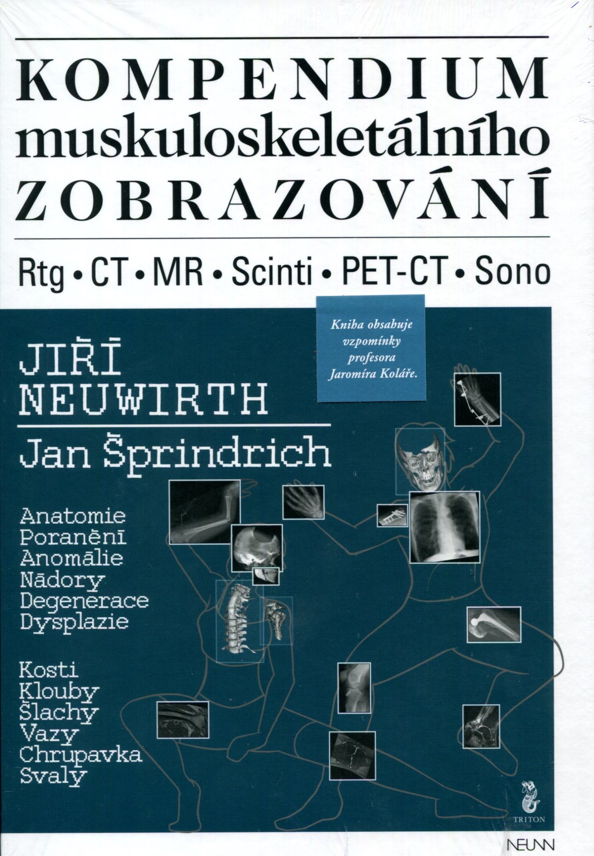 Obrazok Kompendium muskuloskeletálního zobrazování