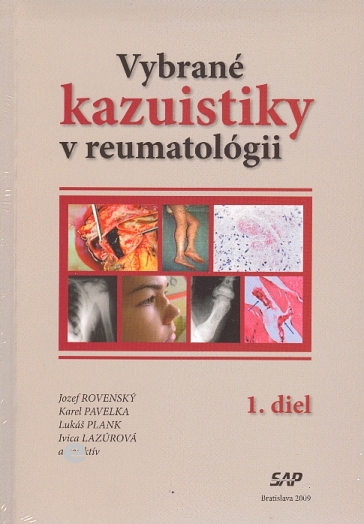 Obrazok Vybrané kazuistiky v reumatológii (1+2 diel)