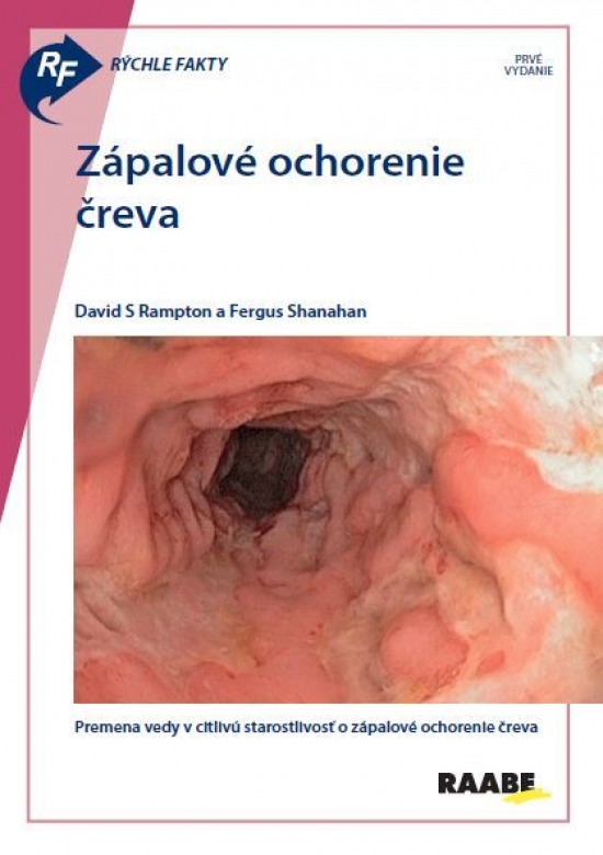 Obrázok Rýchle fakty: Zápalové ochorenie čreva