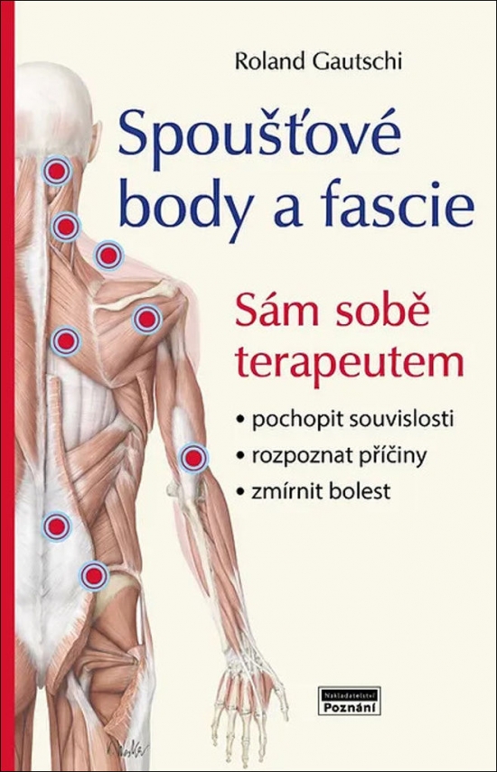 Obrázok Spoušťové body a fascie