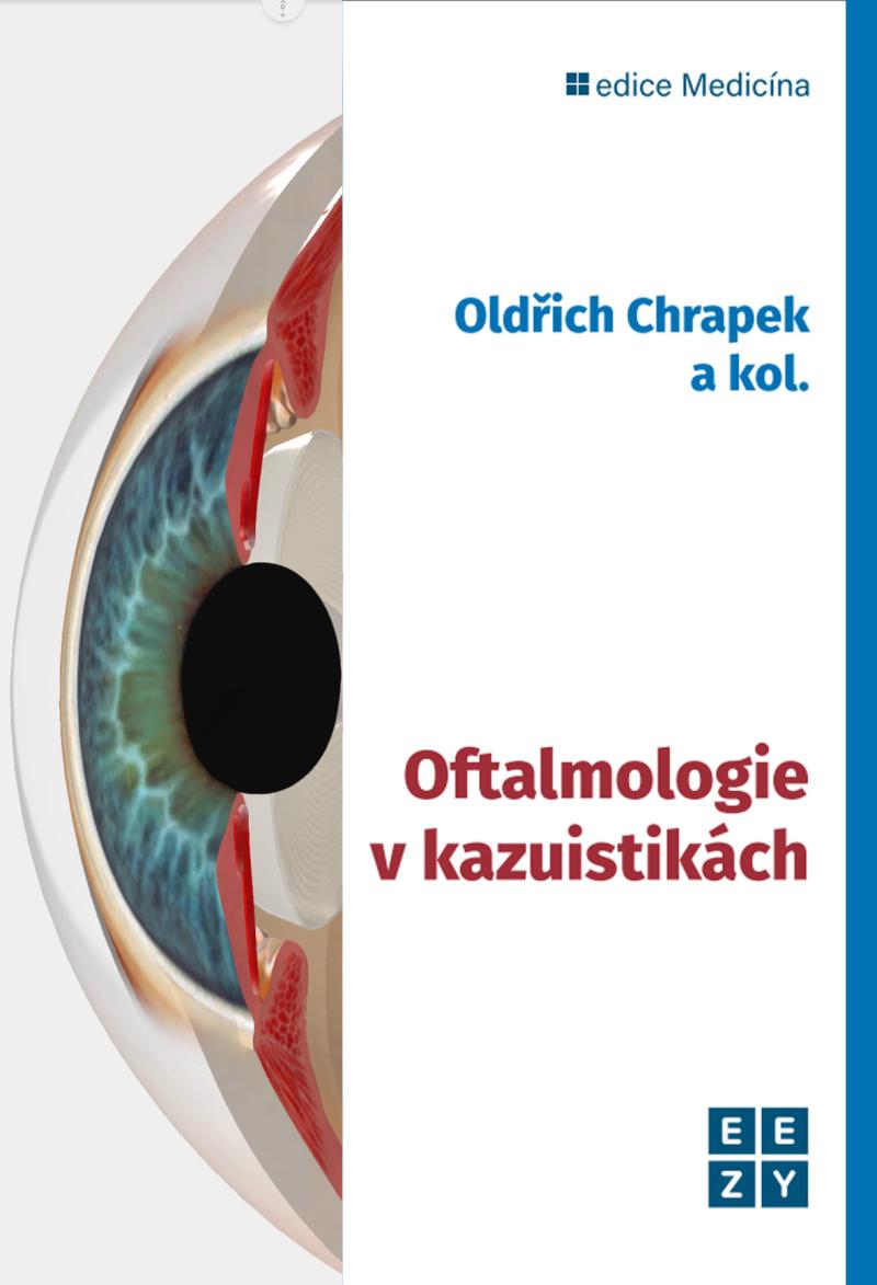 Obrázok Oftalmologie v kazuistikách