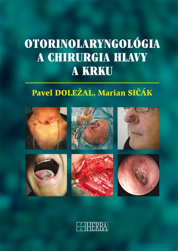 Obrazok Otorinolaryngológia a chirurgia hlavy a krku