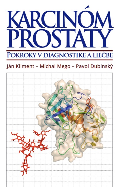 Obrazok Karcinóm prostaty - Pokroky v diagnostike a liečbe