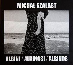 Obrazok Albíni, Albinosi, Albinos