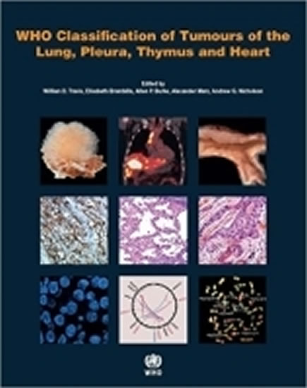 Obrázok WHO classification of tumours of the lung, plura, thymus and heart